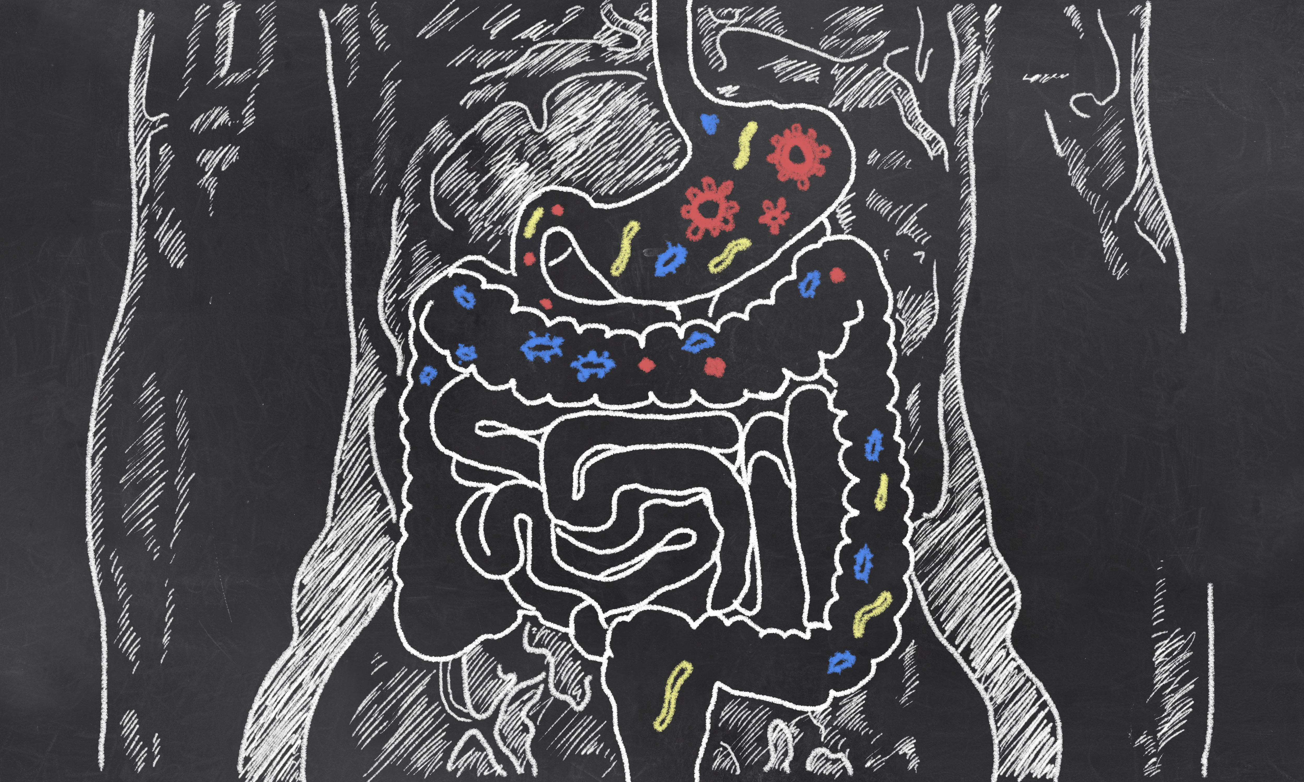 The gut and ME/CFS