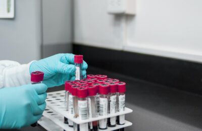 Free samples from the UK ME/CFS Biobank – Winners announced