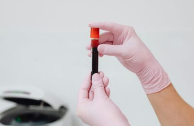 Multimodal analysis in ME/CFS: Disrupted energy metabolism, altered immune function, and vascular dysfunction